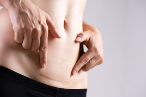 Doba rekonvalescence